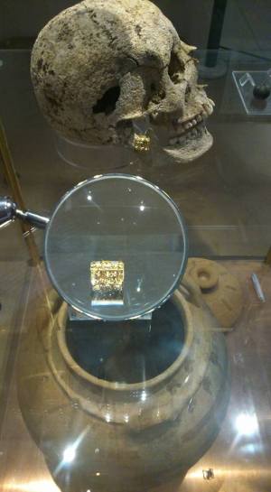 Il teschio della cosiddetta "ragazza delle Porciglia": particolare dell'orecchino "a barilotto" in oro ancora in situ.